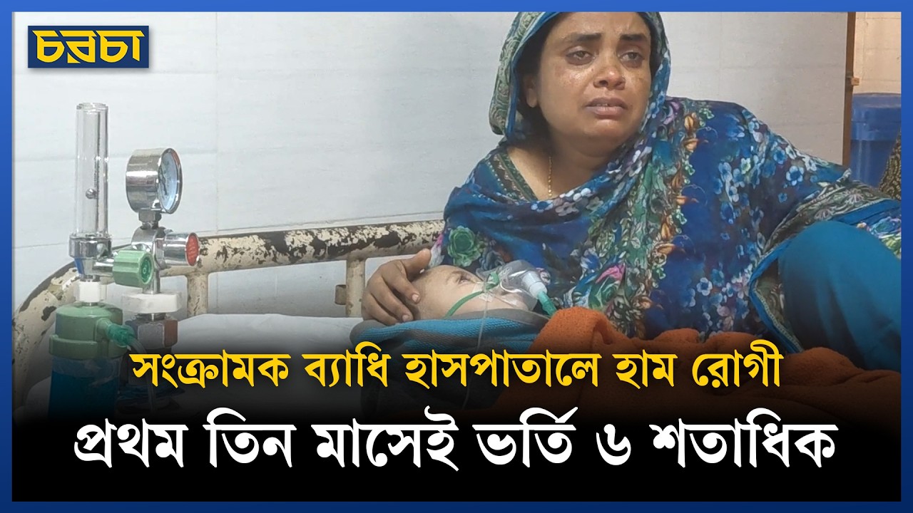 হামের রোগী বেড়েই চলেছে সংক্রামক ব্যাধি হাসপাতালে