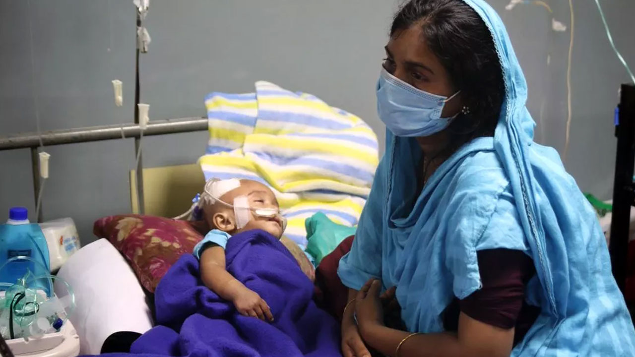 হামের উপসর্গ নিয়ে আরও ৩ প্রাণহানি, আক্রান্ত ১,২২৮