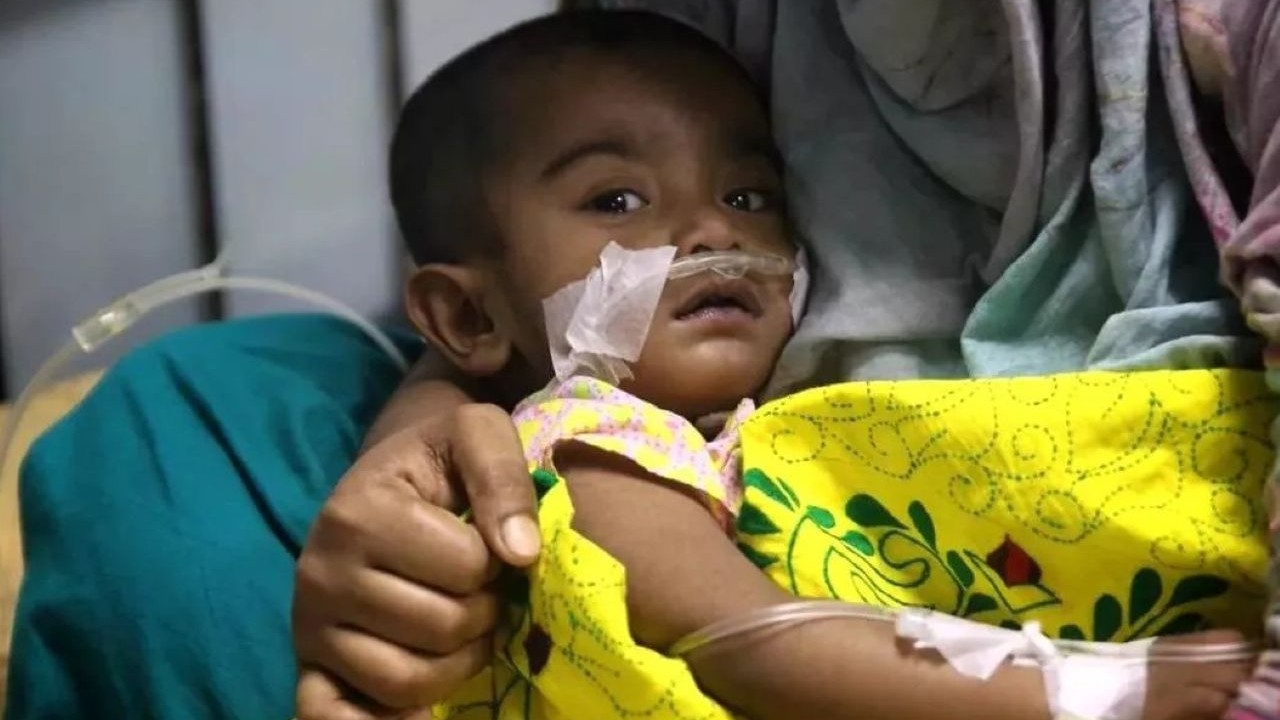 হামের উপসর্গে আরও ৭ শিশুর মৃত্যু, আক্রান্ত ১ হাজার ২৭৩