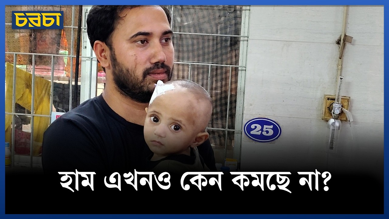 এখন হামে আক্রান্ত শিশুদের কী অবস্থা