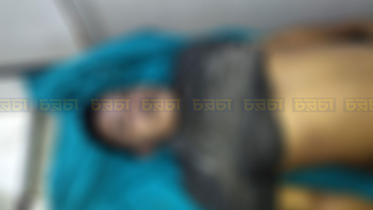 ঢাকা মেডিকেল কলেজ হাসপাতালে সায়মনের মরদেহ। ছবি: চরচা