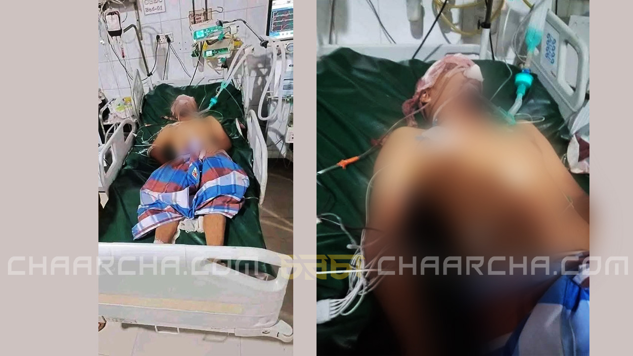 ঢামেক হাসপাতালের ওয়ান স্টপ ক্রাইসিস সেন্টারে মুমূর্ষু অবস্থায় উবাইদুল। ছবি: চরচা